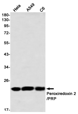 Peroxiredoxin 2 Rabbit mAb