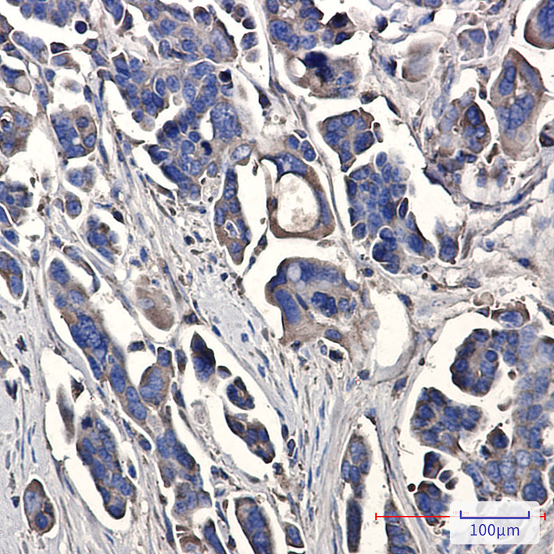 Peroxiredoxin 3 Rabbit mAb