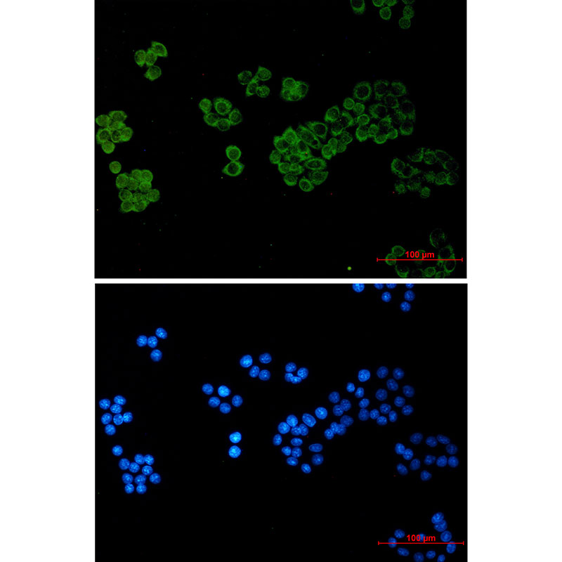 Phospholipase C gamma 1 Rabbit mAb