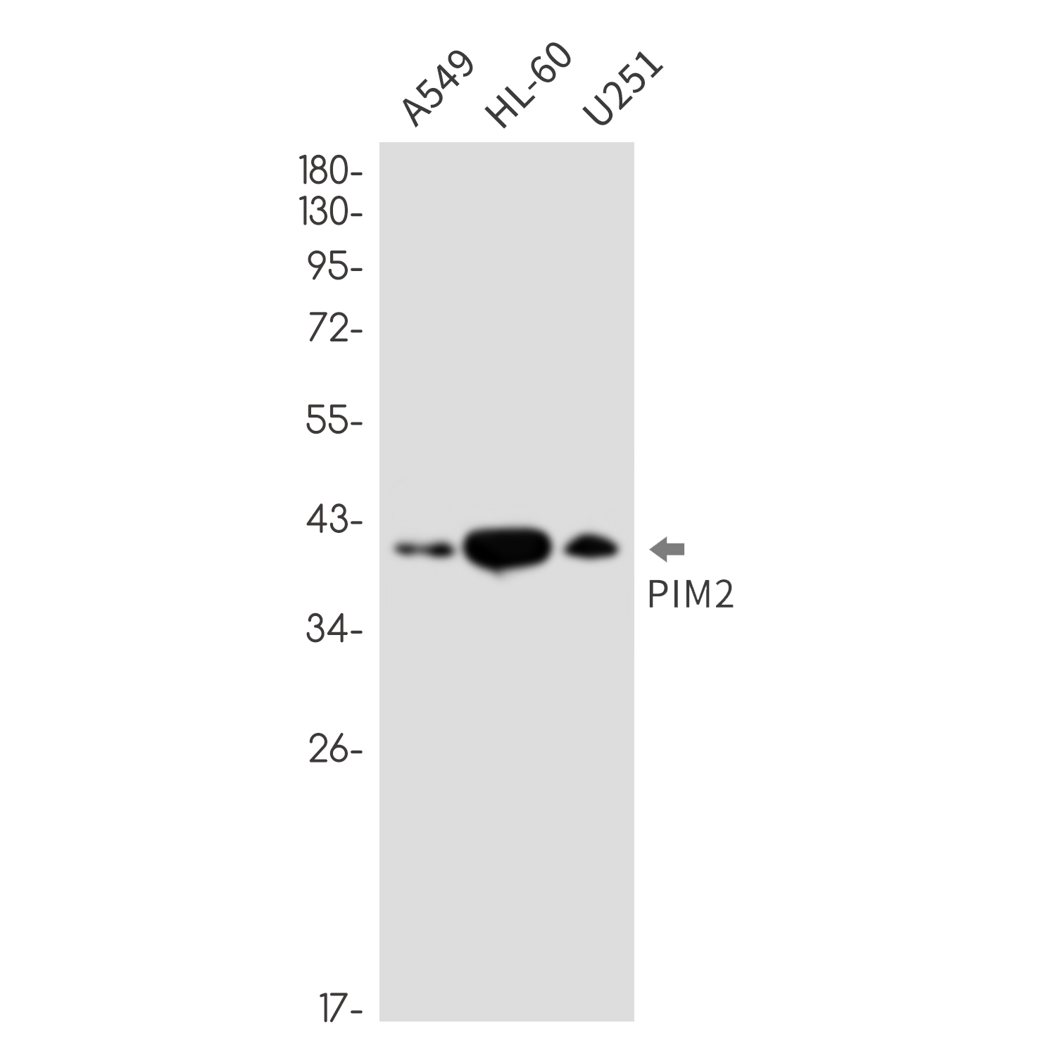 PIM2 Rabbit mAb