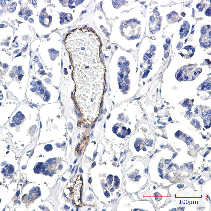 Poliovirus Receptor Rabbit mAb