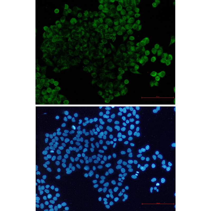 PPP2R5E Rabbit mAb