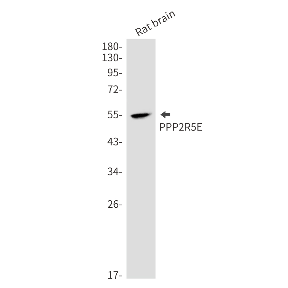 PPP2R5E Rabbit mAb