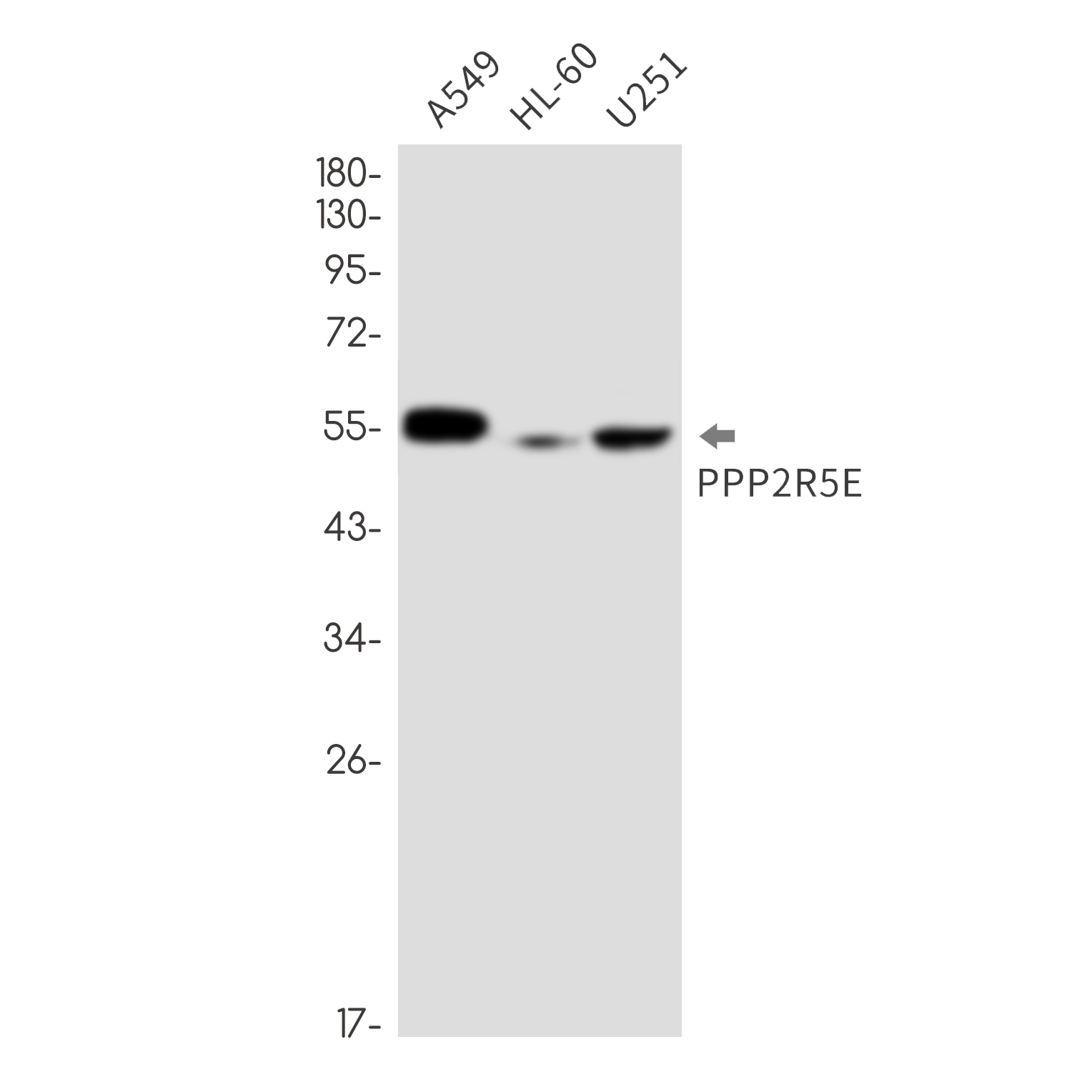 PPP2R5E Rabbit mAb