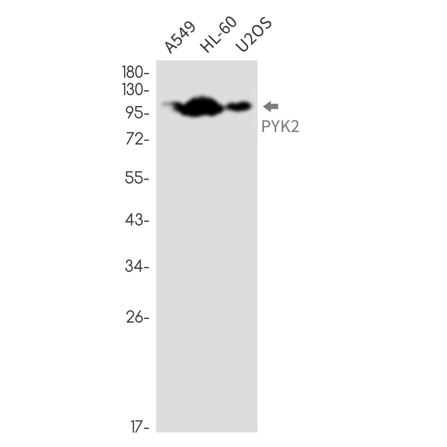 PYK2 Rabbit mAb