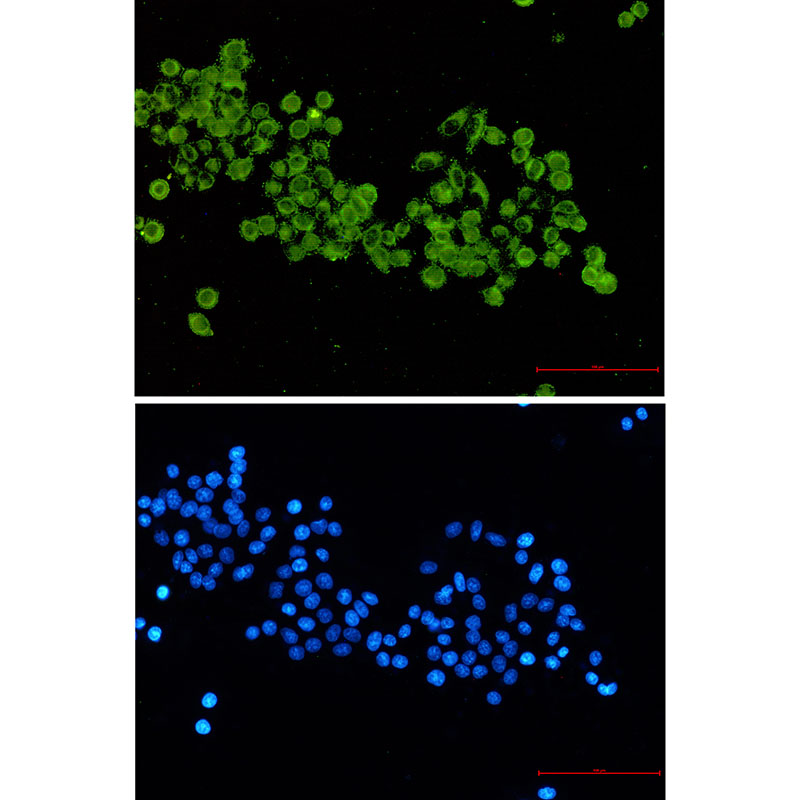 Pyruvate Dehydrogenase E2 Rabbit mAb