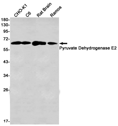 Pyruvate Dehydrogenase E2 Rabbit mAb