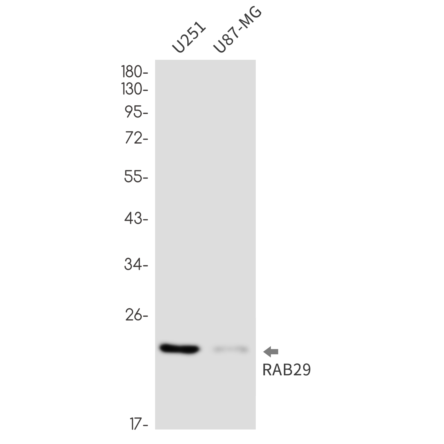 Rab29 Rabbit mAb