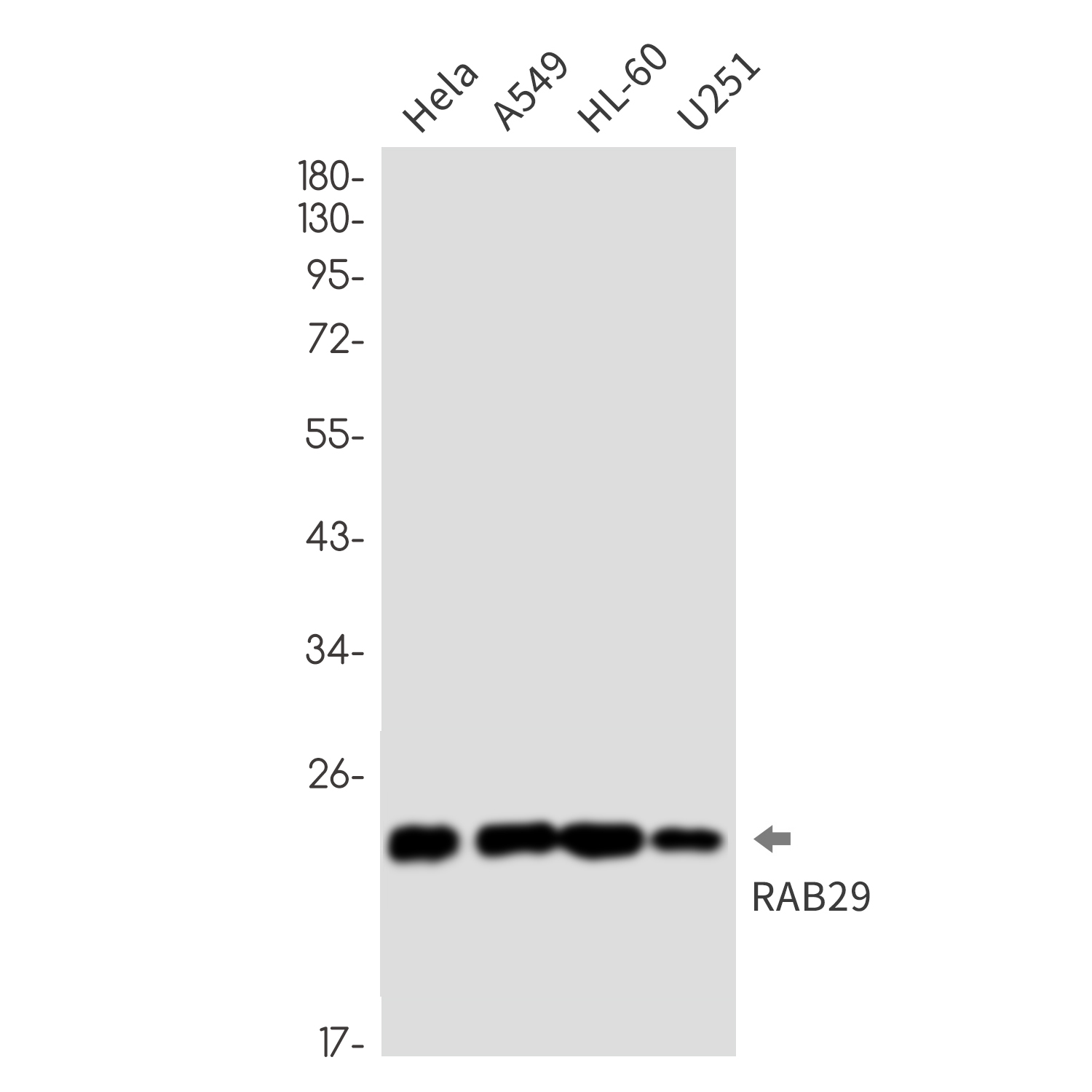 Rab29 Rabbit mAb