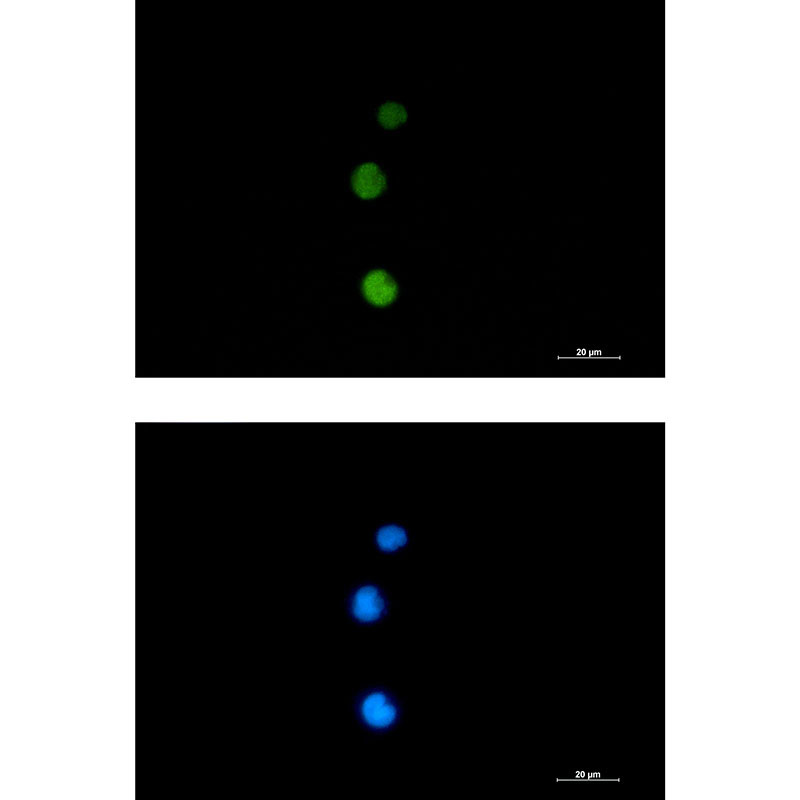 Rad51 Rabbit mAb