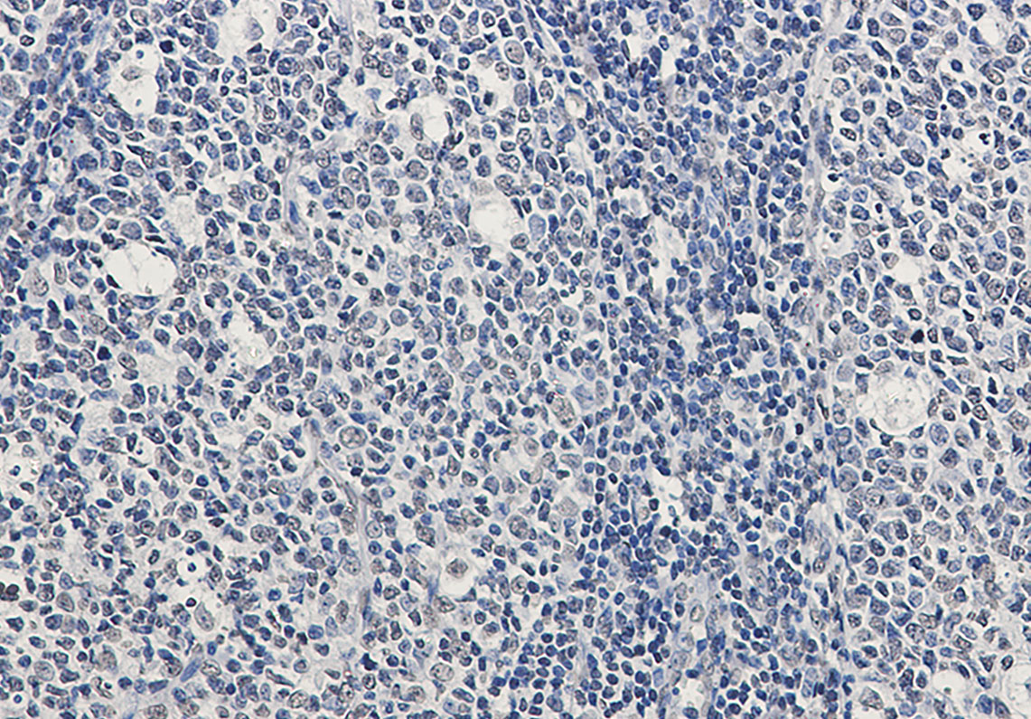 Rad51 Rabbit mAb