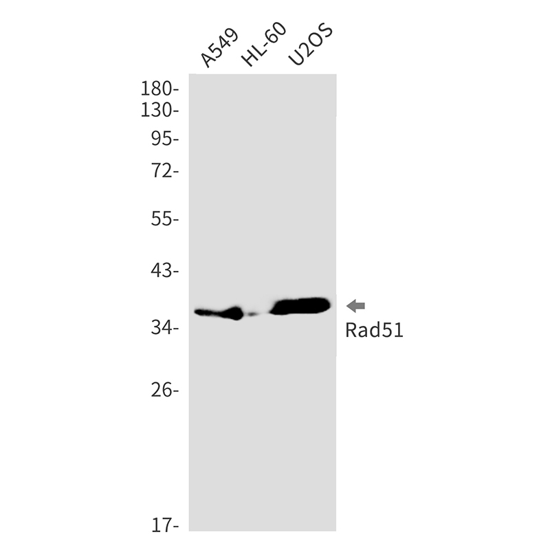 Rad51 Rabbit mAb