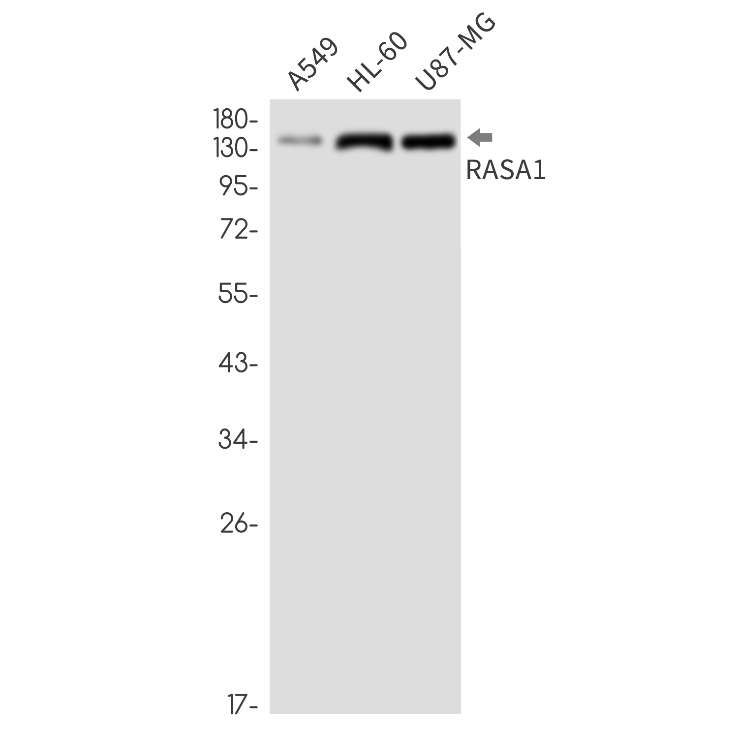 RASA1 Rabbit mAb