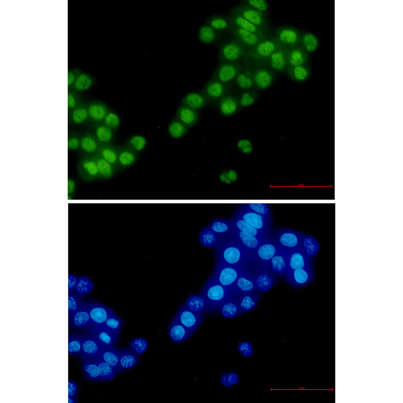 RBM3 Rabbit mAb