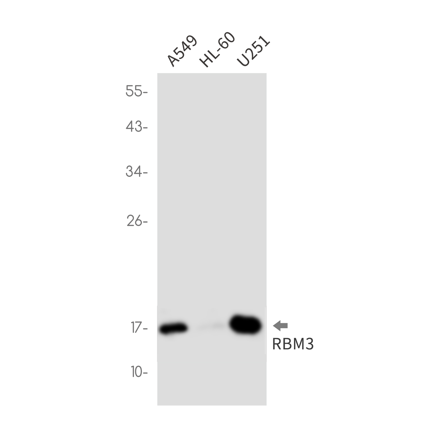 RBM3 Rabbit mAb