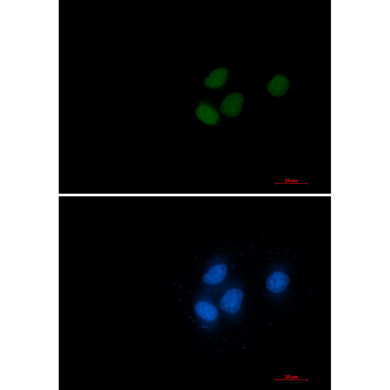 RCC1 Rabbit mAb