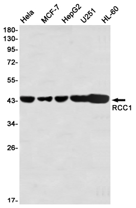 RCC1 Rabbit mAb