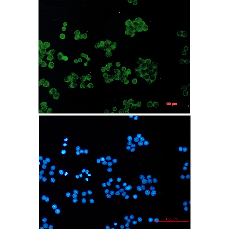 RhoGDI Rabbit mAb