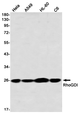 RhoGDI Rabbit mAb