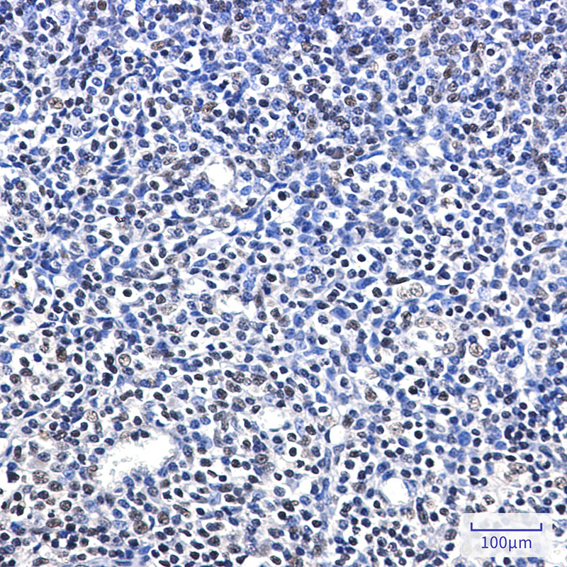 RPA32 Rabbit mAb