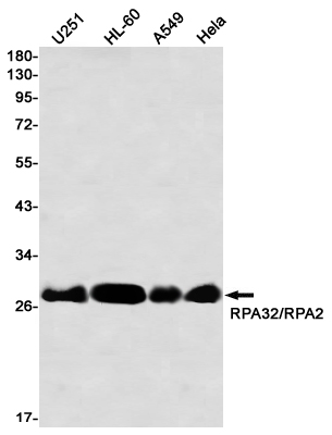 RPA32 Rabbit mAb