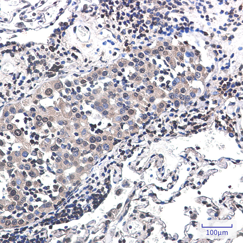 RSK2 Rabbit mAb