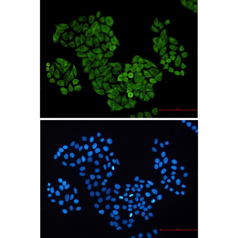 S100 alpha6 Rabbit mAb