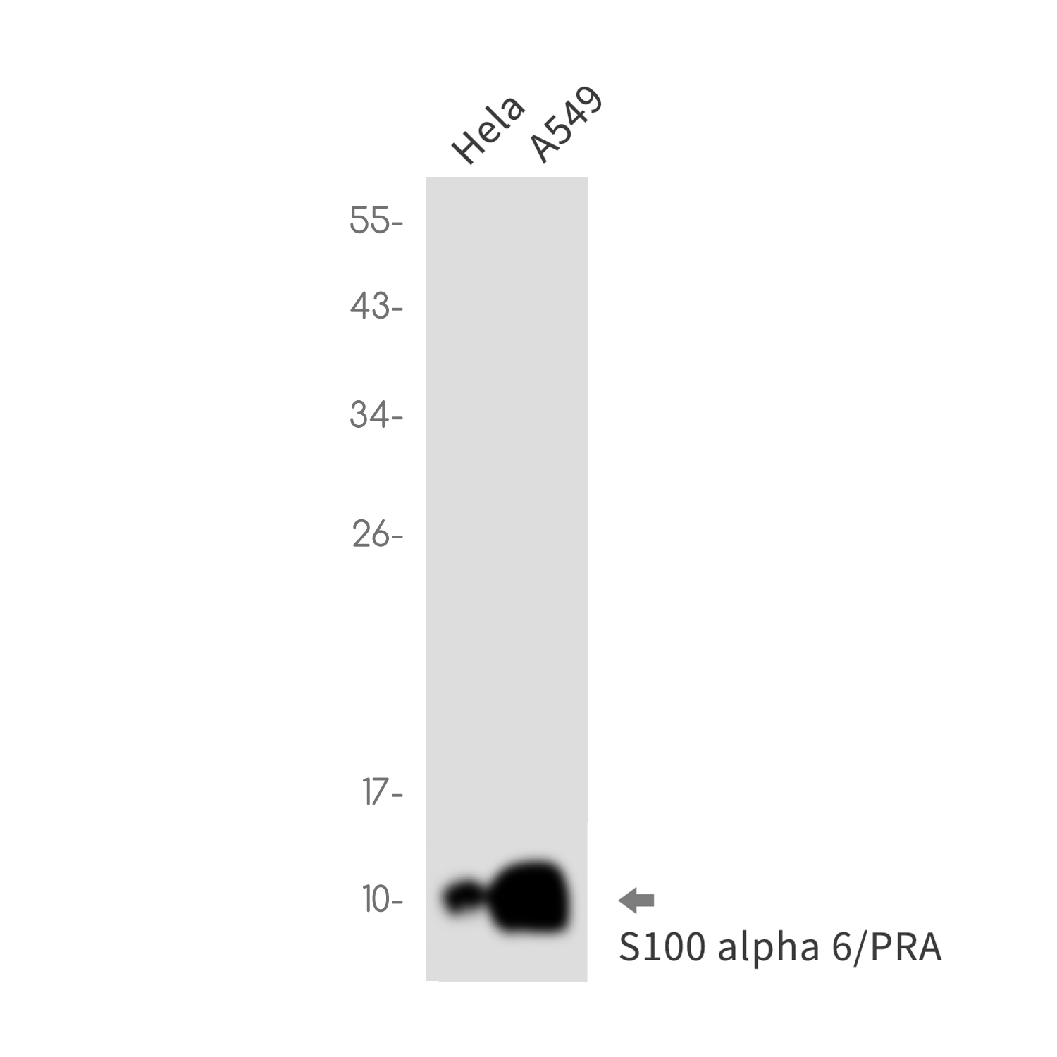 S100 alpha6 Rabbit mAb