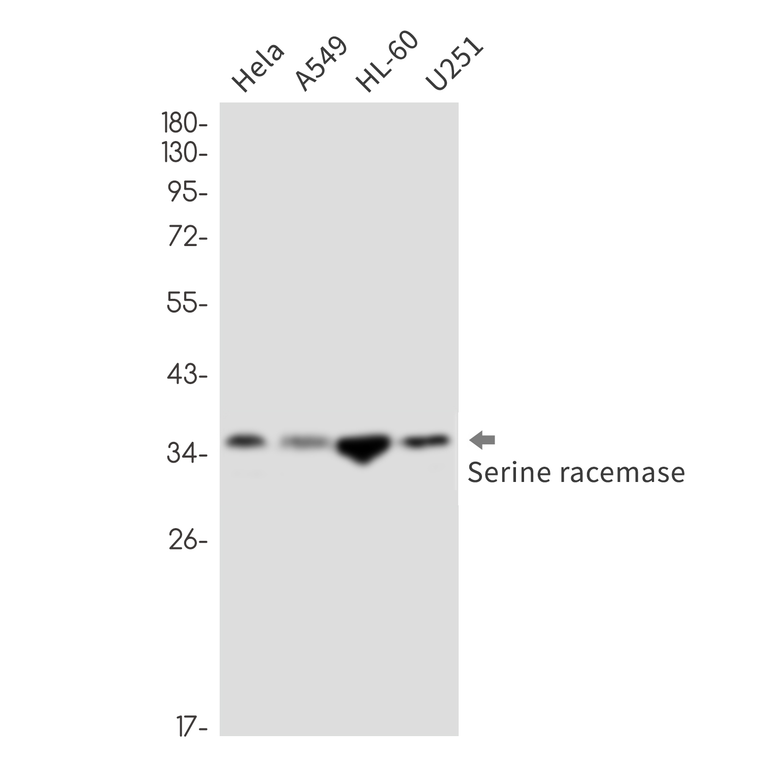 Serine Racemase Rabbit mAb