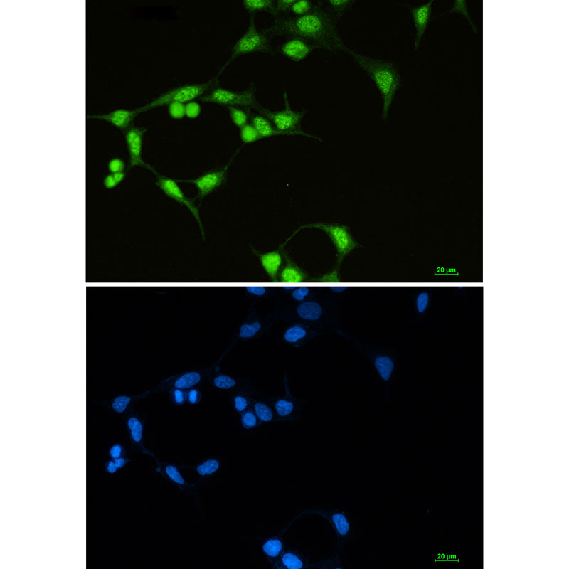 SF3B1 Rabbit mAb