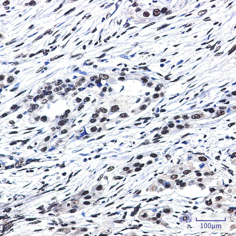 SF3B1 Rabbit mAb