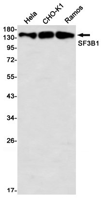 SF3B1 Rabbit mAb