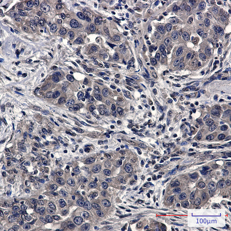 SFT Rabbit mAb