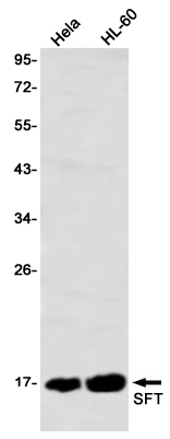 SFT Rabbit mAb