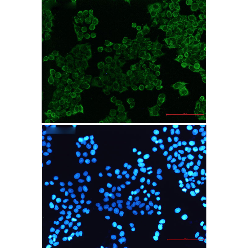 SIRP alpha Rabbit mAb