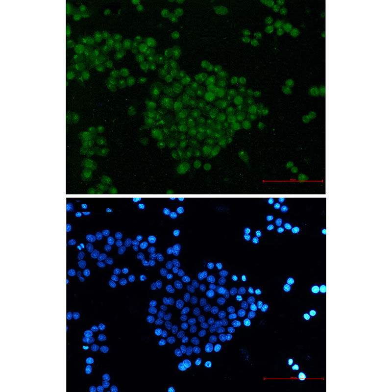 SKP2 Rabbit mAb