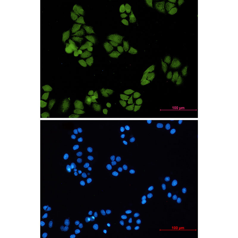 Smad4 Rabbit mAb