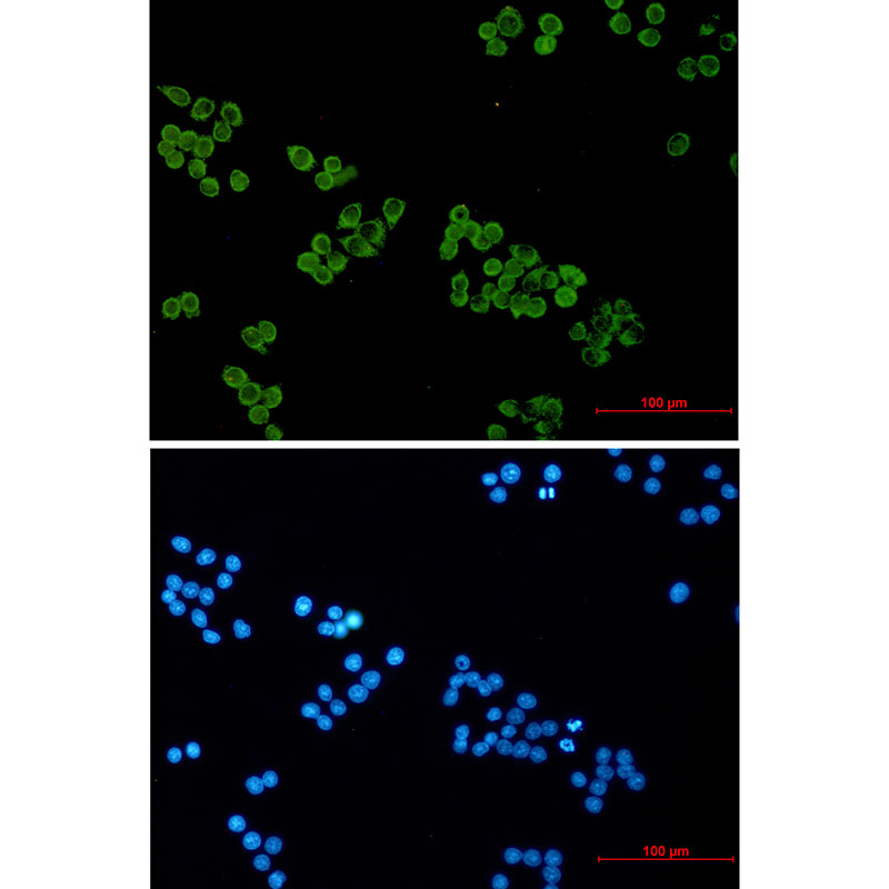 SNAP25 Rabbit mAb