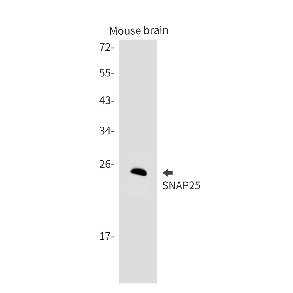 SNAP25 Rabbit mAb