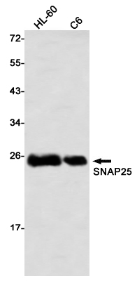 SNAP25 Rabbit mAb