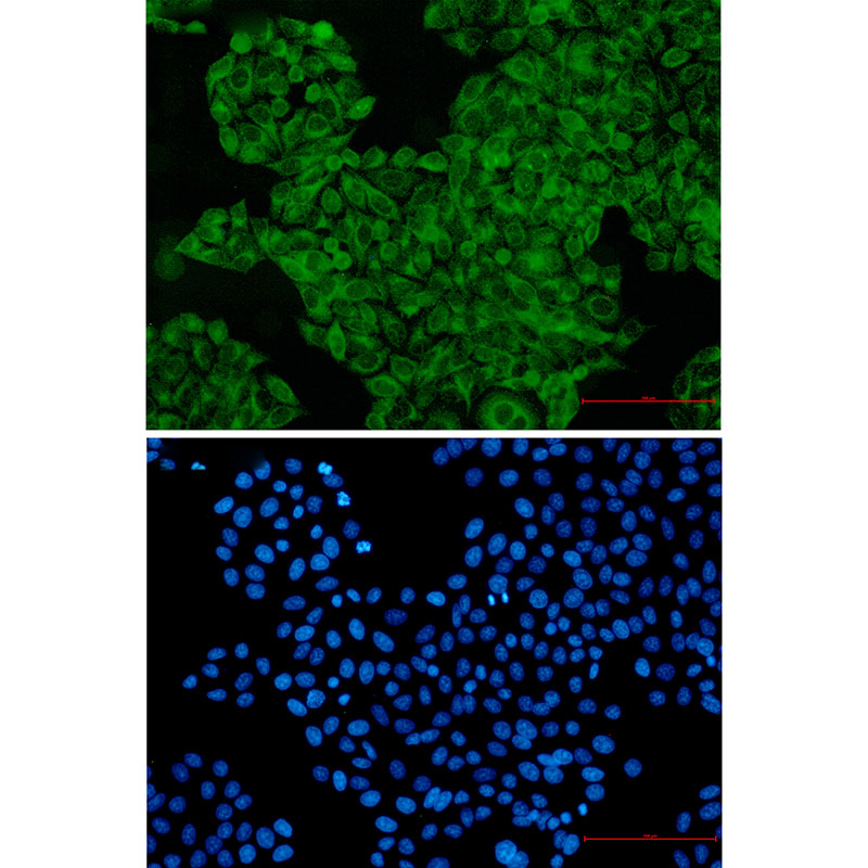 SNX1 Rabbit mAb