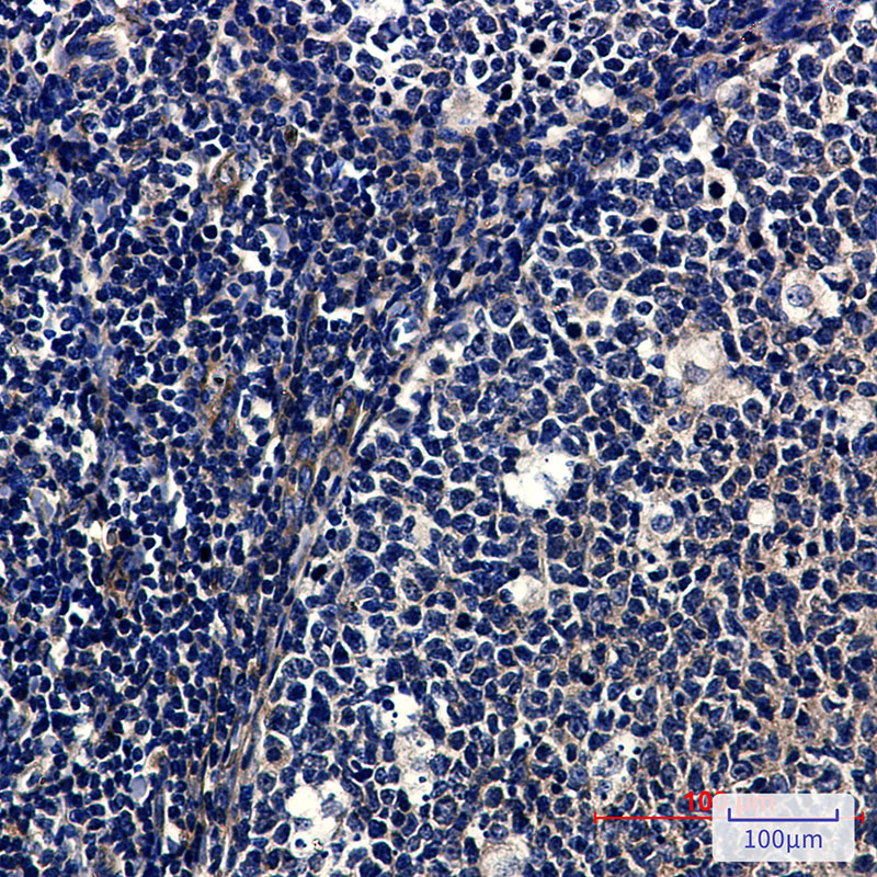 SNX1 Rabbit mAb