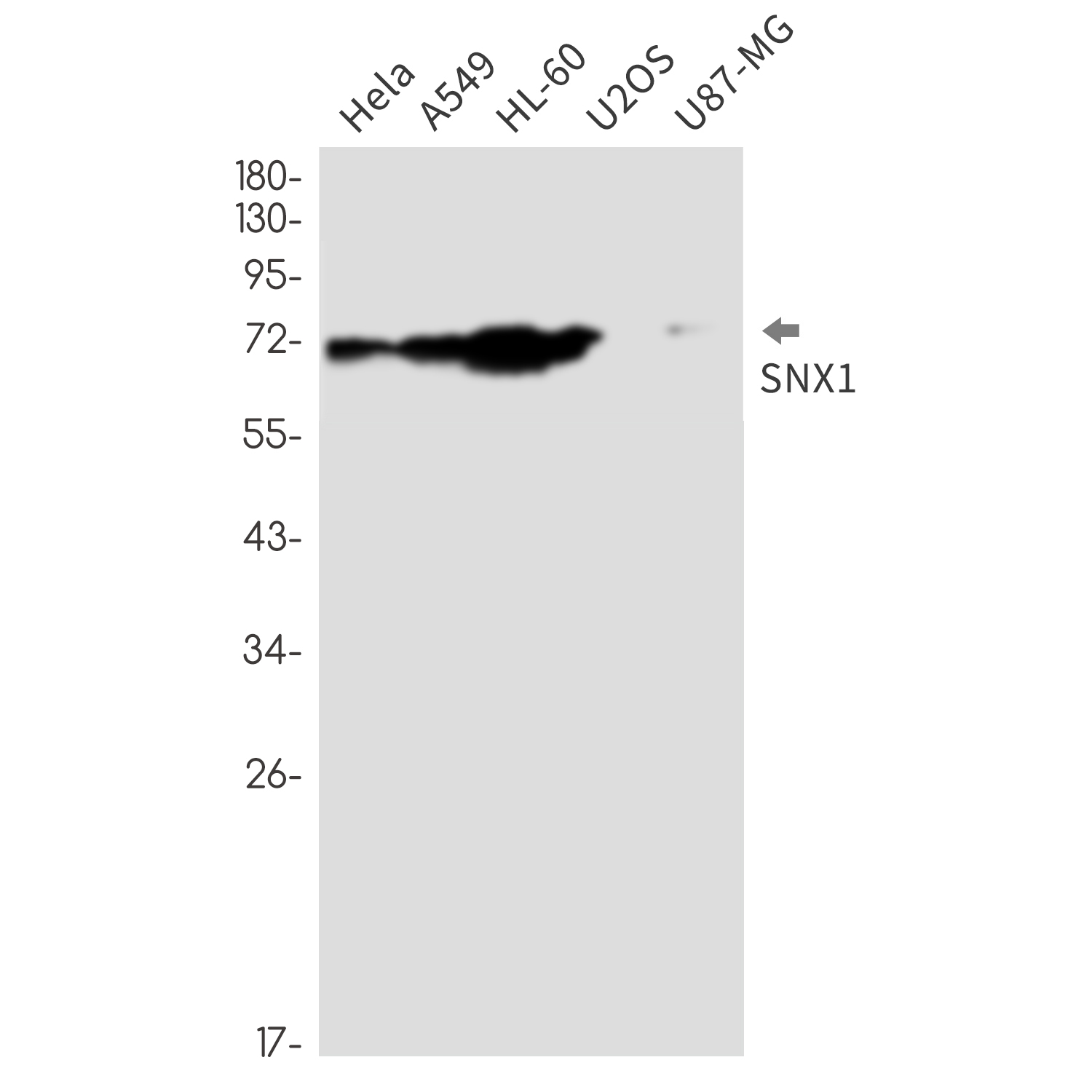 SNX1 Rabbit mAb