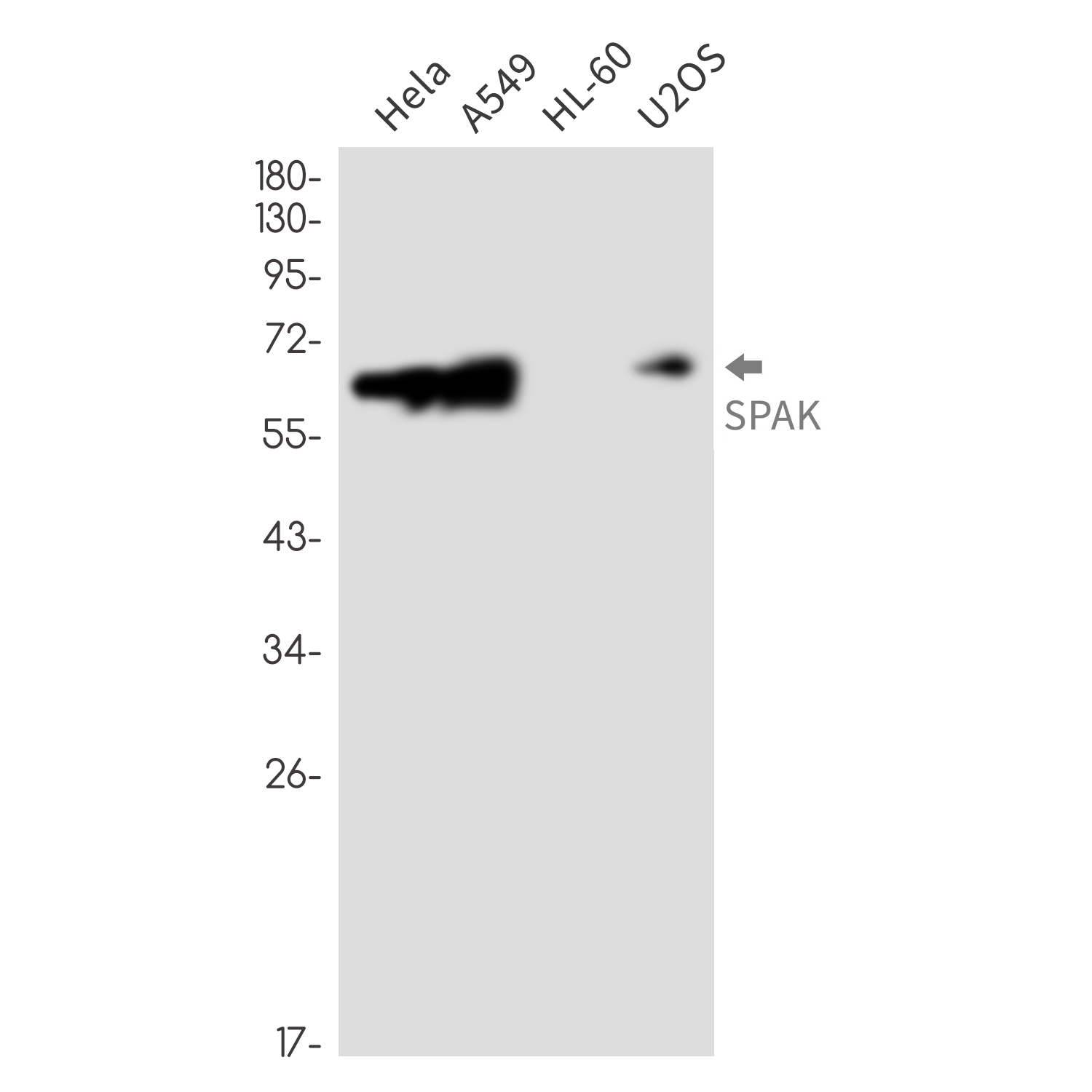 SPAK Rabbit mAb