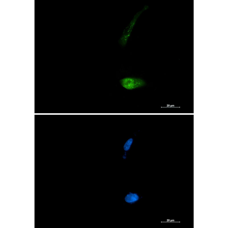 SQSTM1/p62 Rabbit mAb