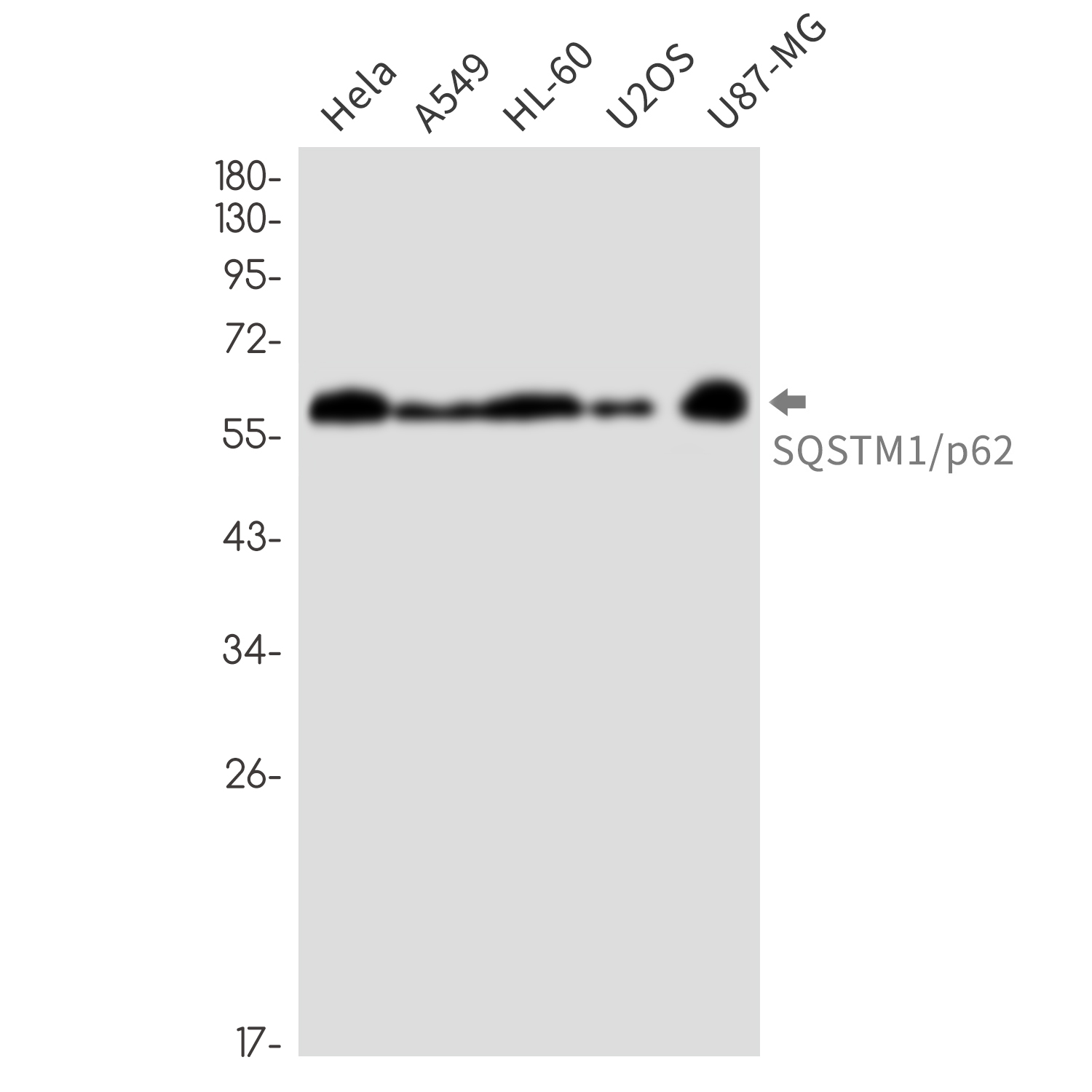 SQSTM1/p62 Rabbit mAb