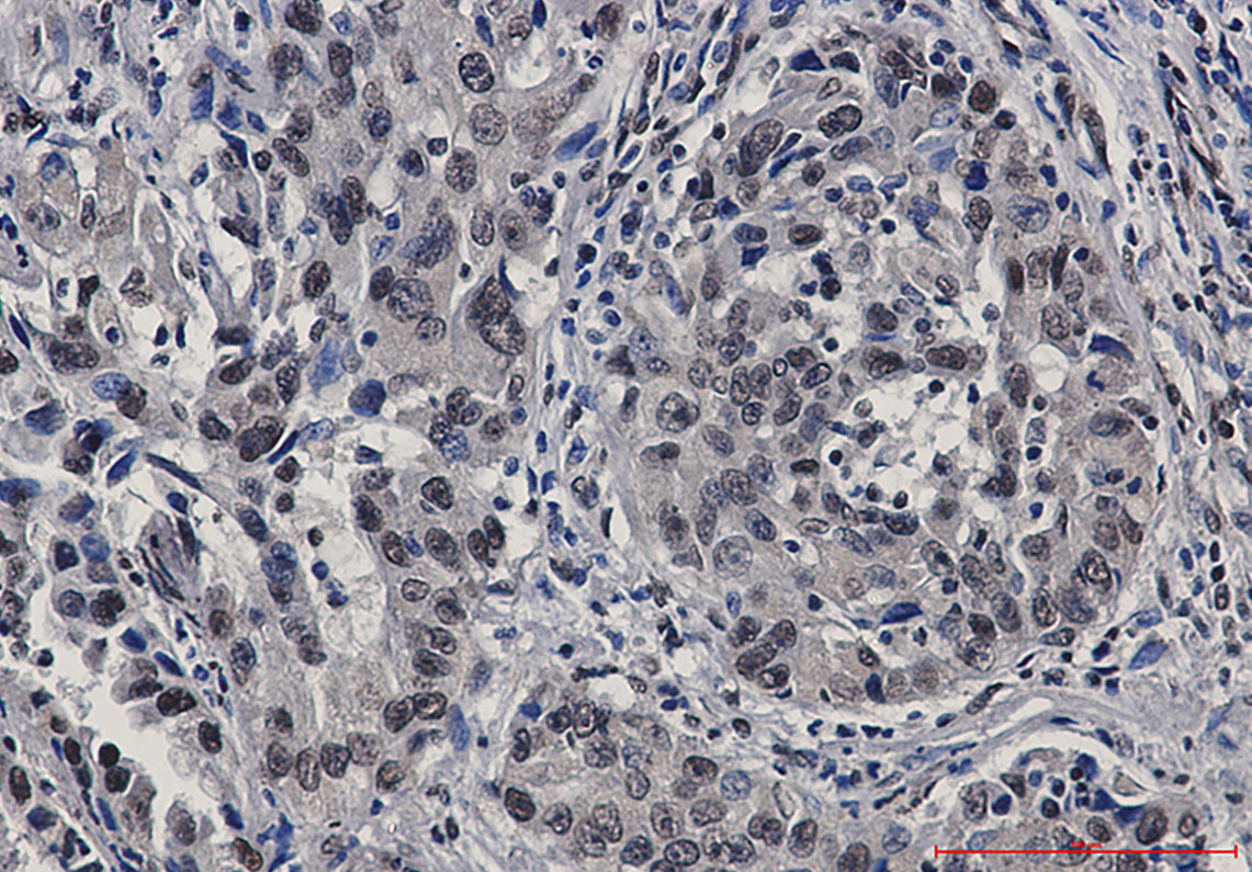 STAT4 Rabbit mAb