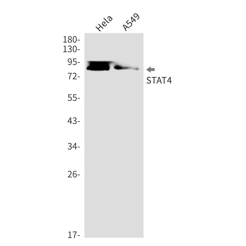 STAT4 Rabbit mAb