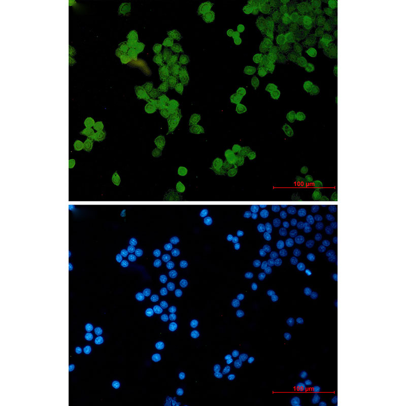 STAT5b Rabbit mAb