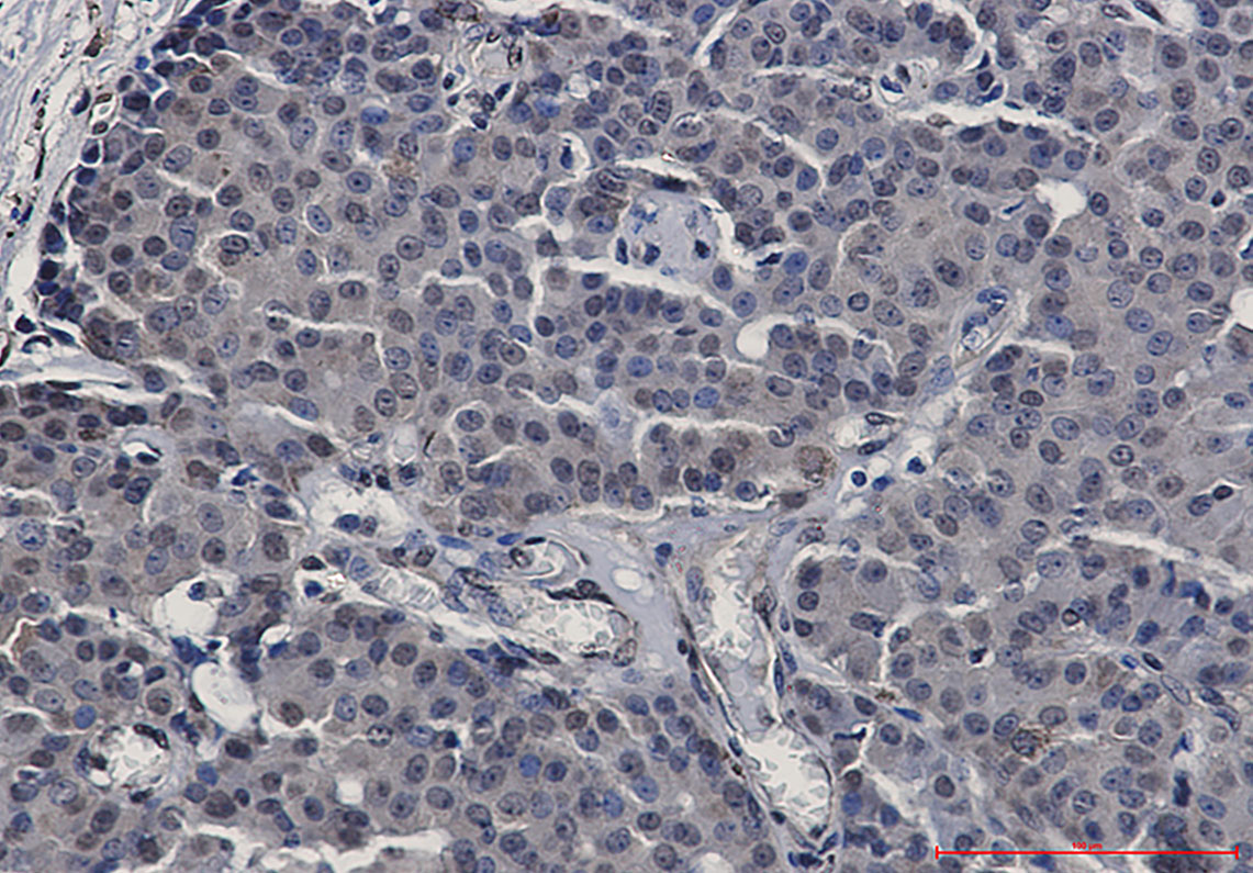 STAT5b Rabbit mAb